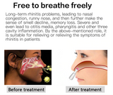 Bionase Allergy Reliever Relief Low-frequency Laser Rhinitis Sinusitis Therapy